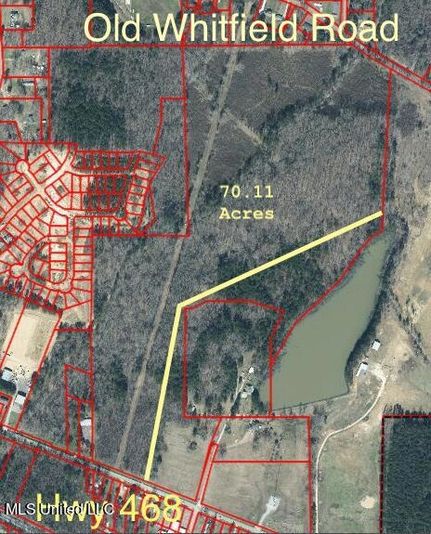 Property for sale in Rankin County, Mississippi